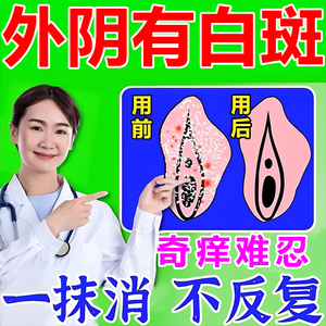 治疗外阴白斑最新药物概览与新药解析